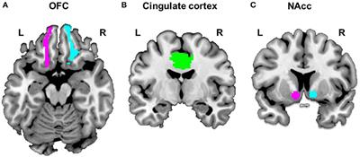 Role of Frontostriatal Connectivity in Adolescents With Excessive Smartphone Use